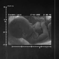 Cover art for Giovanni Louis album 1995